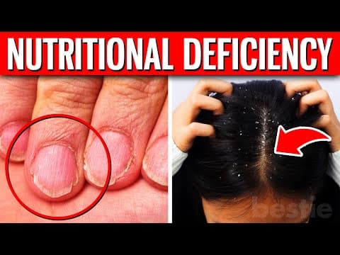 12 ALARMING Signs That Indicate You Have A Nutritional Deficiency
