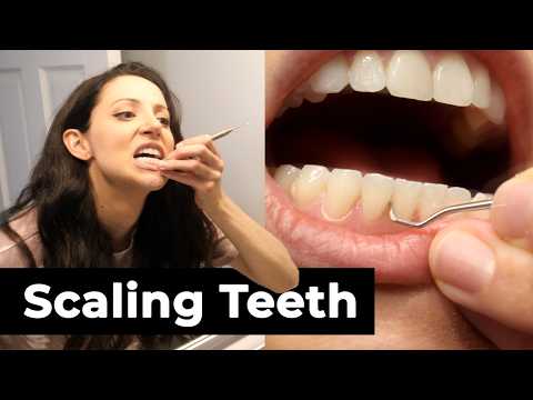 Scaling Your Own Teeth At Home